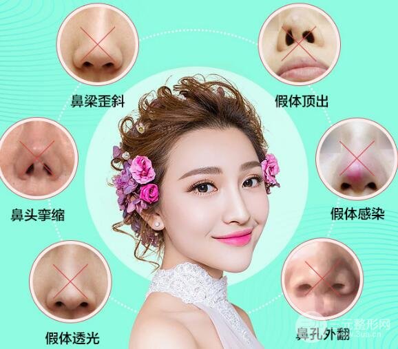 隆鼻失敗怎么辦？鼻修復(fù)手術(shù)是怎么做的？