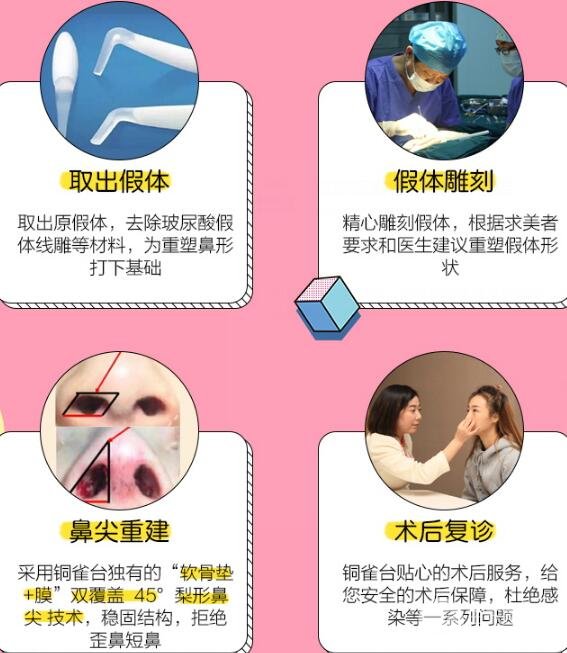 隆鼻失敗怎么辦？鼻修復(fù)手術(shù)過程