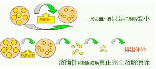 注射溶脂減肥瘦身的原理