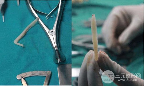 假體隆鼻注意事項有哪些呢？趕緊來科普一下吧~