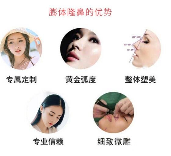 膨體隆鼻優(yōu)點介紹