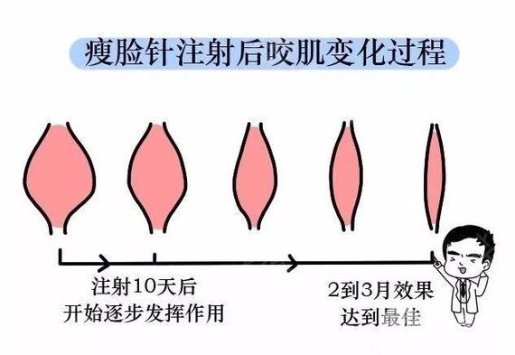 圓臉怎么變瓜子臉