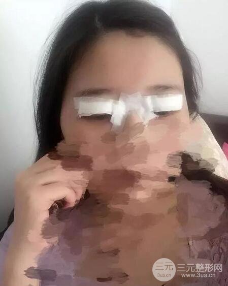 新星靚劉風(fēng)卓眼修復(fù)