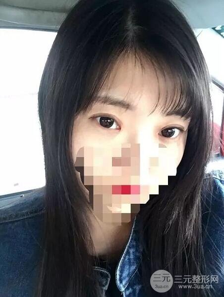 新星靚劉風(fēng)卓眼修復(fù)