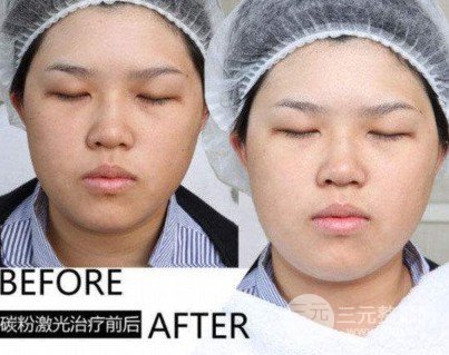 做黑臉娃娃的費(fèi)用多少