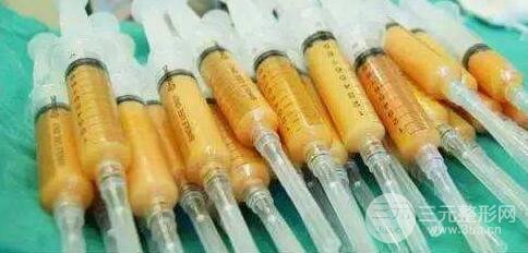 什么是脂肪填充?