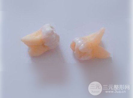 福建醫(yī)科大學(xué)附屬口腔醫(yī)院拔智齒掛啥科