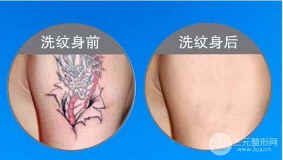 洗完紋身后的圖片