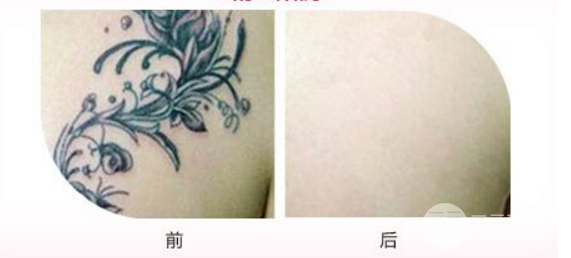 洗完紋身后的圖片