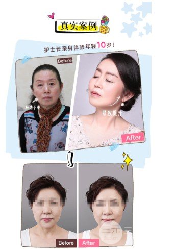 美版熱拉提和韓版的區(qū)別