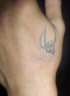 洗紋身事項(xiàng)問與答：