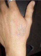 洗紋身事項(xiàng)問與答：