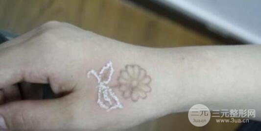 洗紋身事項(xiàng)問與答：