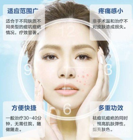 激光去痘印價格多少