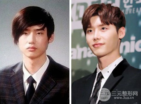 李鐘碩整容前后照片