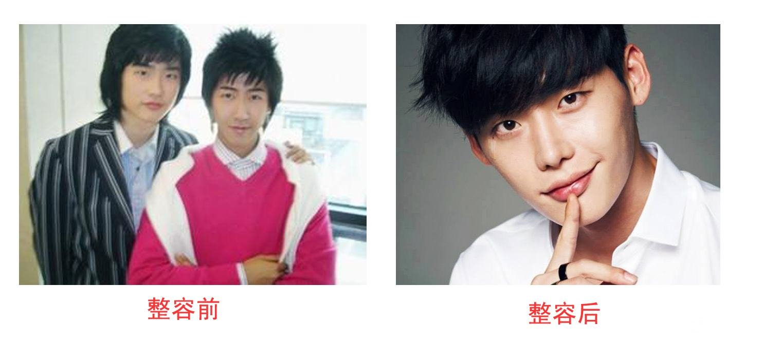 李鐘碩整容前后照片