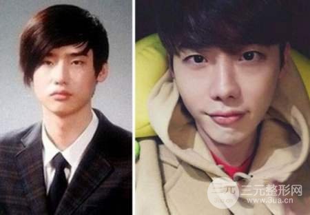 李鐘碩整容前后照片