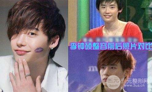 李鐘碩整容前后照片