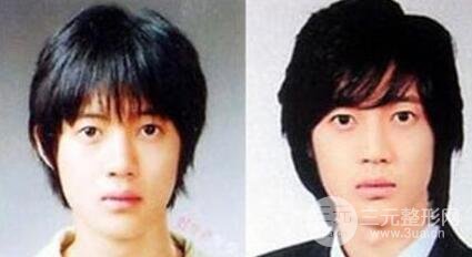 金賢重對(duì)整形的回應(yīng)