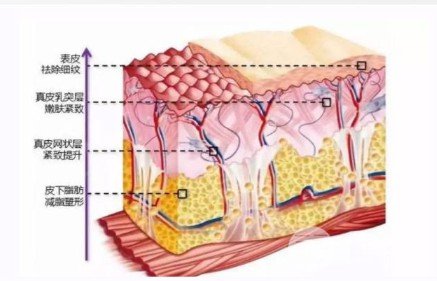 怎么樣去法令紋