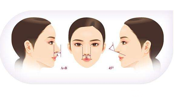 假體隆鼻手術(shù)降低風(fēng)險嗎