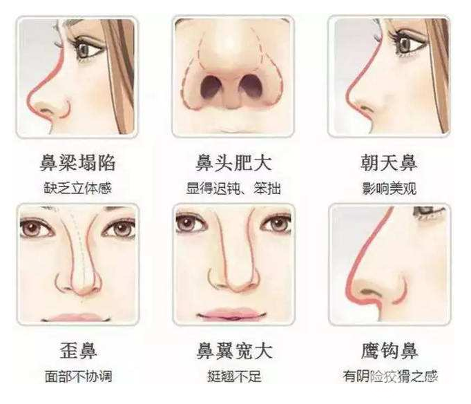 假體隆鼻手術(shù)降低風(fēng)險嗎