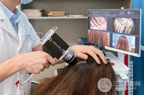 河南植發(fā)正規(guī)醫(yī)院收費(fèi)標(biāo)準(zhǔn)