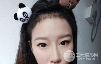 河南植發(fā)正規(guī)醫(yī)院收費(fèi)標(biāo)準(zhǔn)