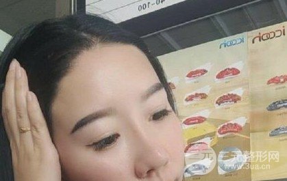 河南植發(fā)正規(guī)醫(yī)院收費(fèi)標(biāo)準(zhǔn)