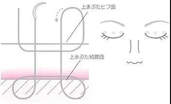 日本*醫(yī)志|二十年如一日，專(zhuān)注埋線雙眼皮的整形大師~