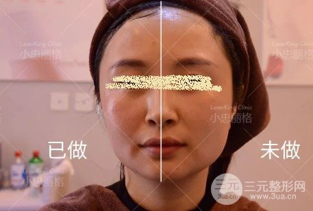 熱瑪吉原理及作用