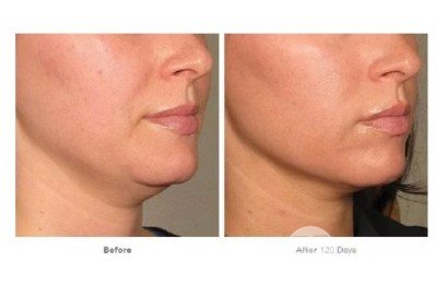 做完熱瑪吉注意事項(xiàng)