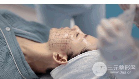 做完熱瑪吉臉失敗