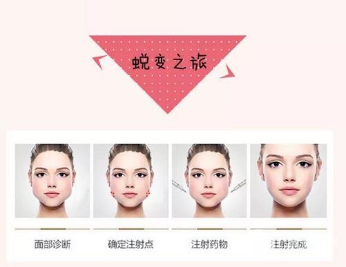 注射注射瘦臉后的護理方法