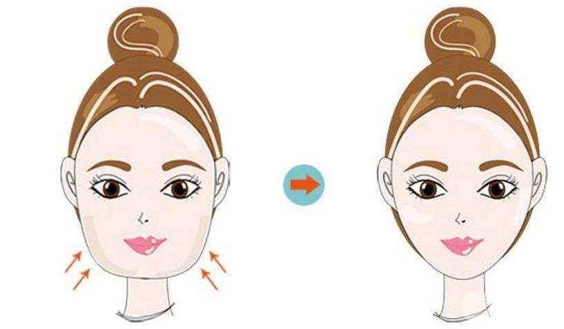 下巴吸脂多少錢(qián)