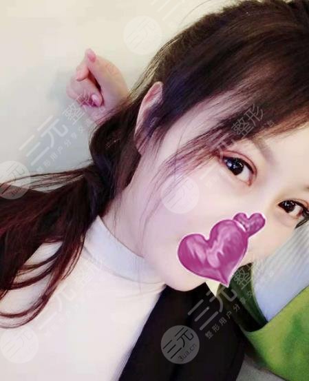 遵義醫(yī)學院附屬醫(yī)院整形祛斑案例