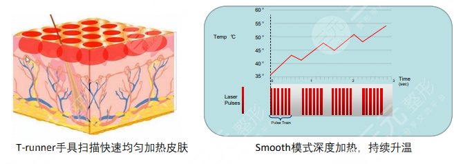 火鳳凰溶脂原理