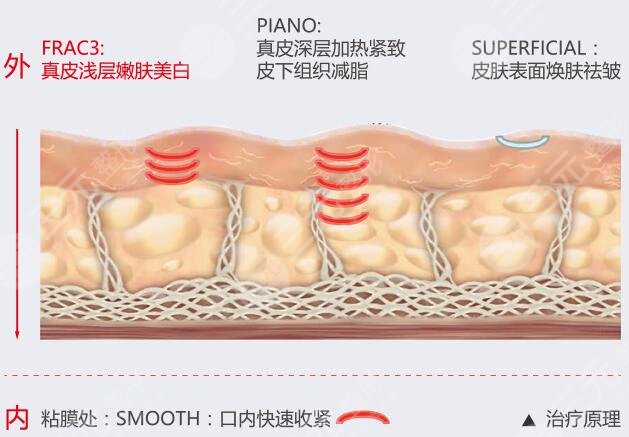 火鳳凰溶脂原理
