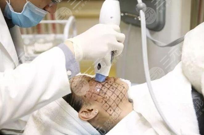 熱瑪吉一次管多久？