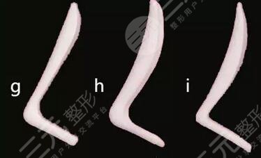 硅膠假體隆鼻材料品牌有哪些