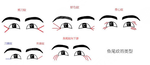 魚尾紋如何產(chǎn)生的