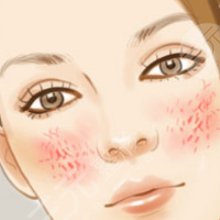 怎么去臉上的紅血絲