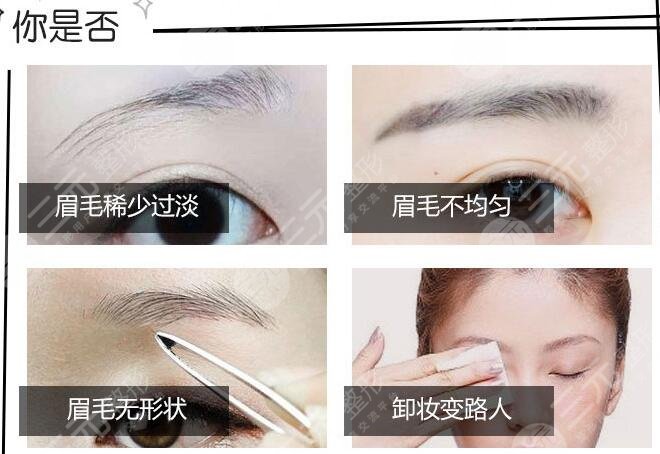 北京繡眉價(jià)格