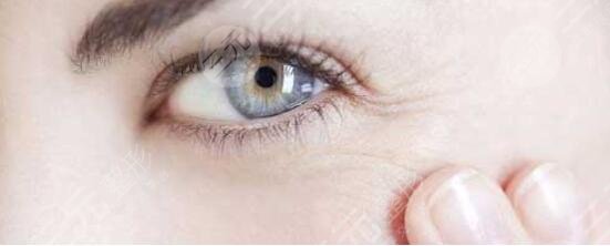 去掉眼角魚(yú)尾紋的價(jià)格是多少錢(qián)？真實(shí)術(shù)后果參考一下~