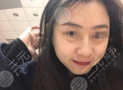 上海九院熱瑪吉過程分享