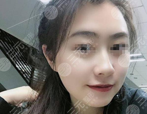 上海九院熱瑪吉過程分享