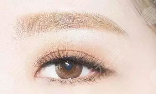 植眉毛多久能恢復(fù)正常？植眉手術(shù)成好嗎？有哪些注意事項(xiàng)呢？