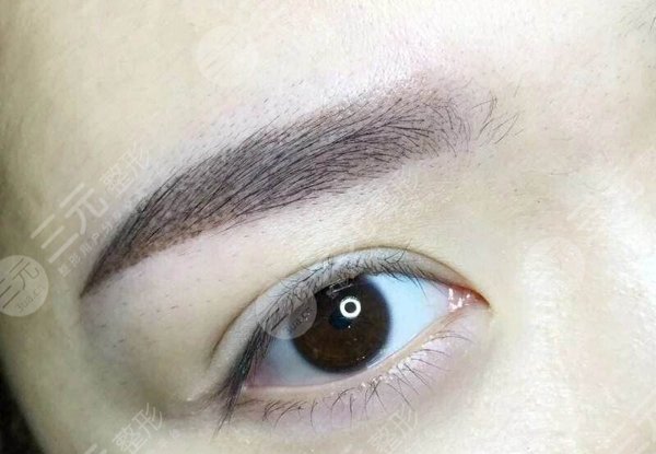 植眉毛手術(shù)恢復(fù)時(shí)間