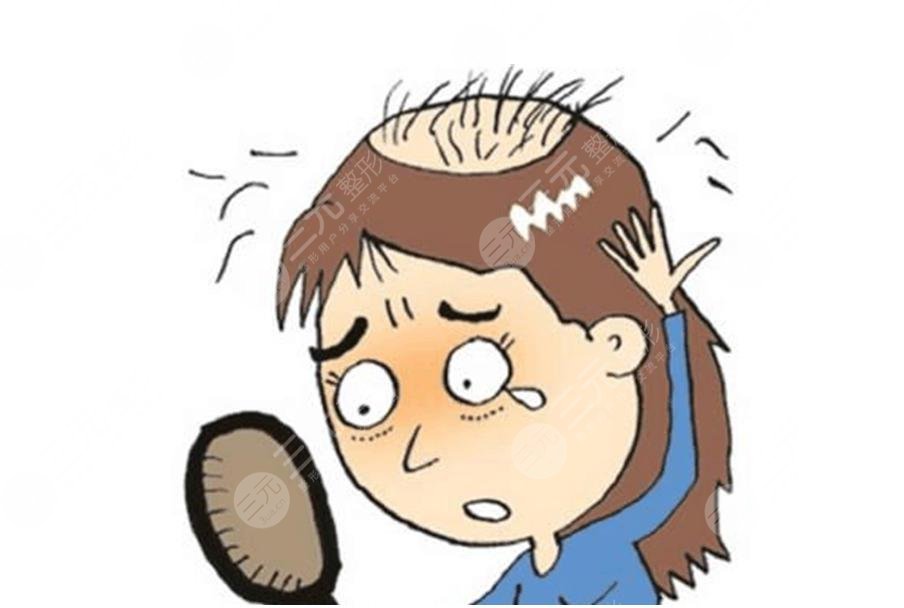 植發(fā)后還會脫落嗎？能夠維持多久？附術(shù)后注意事項