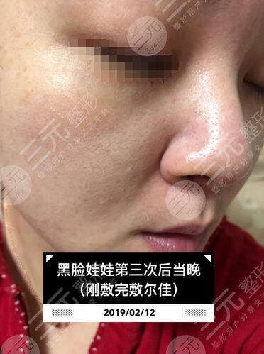 　黑臉娃娃親身體驗(yàn)案例